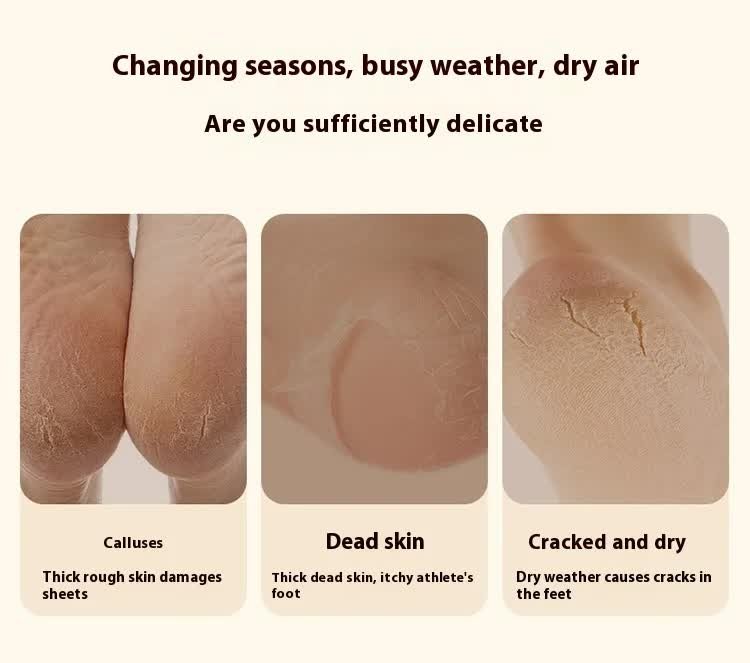 Electric Foot Callus Remover Rechargeable Pedicure Tool with 3 Grinding Heads Portable Dead Skin Exfoliator Ivory White - V888-ELOSUNG44020 Electric Foot Callus Remover Rechargeable Pedicure Tool with 3 Grinding Heads Portable Dead Skin Exfoliator Ivory White - Image 3