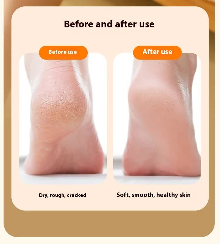 Electric Foot Callus Remover Rechargeable Pedicure Tool with 3 Grinding Heads Portable Dead Skin Exfoliator Ivory White - V888-ELOSUNG44020 Electric Foot Callus Remover Rechargeable Pedicure Tool with 3 Grinding Heads Portable Dead Skin Exfoliator Ivory White - Image 9